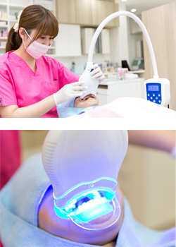 歯根治療について